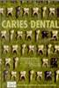 CARIES_DENTAL