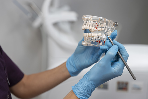 La Revolución Silenciosa: Biomateriales en la Odontología Moderna 4