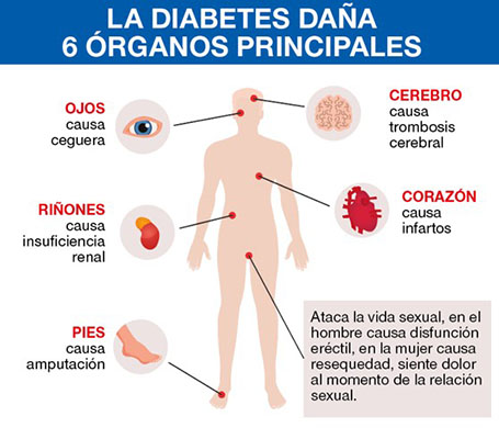 La glucosa alta no duele, pero daña tu organismo 3