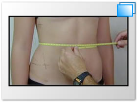 Resultado de imagen para como medir correctamente el abdomen